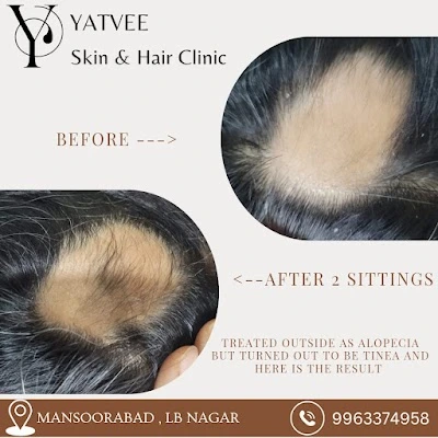 yatvee5